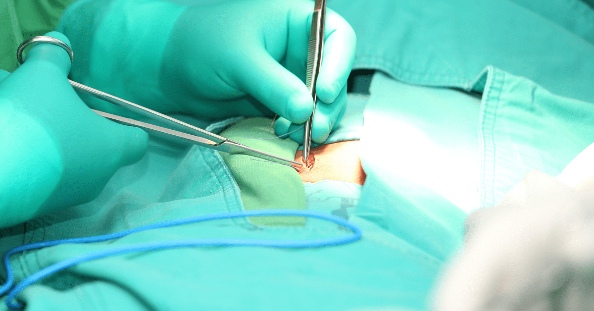 Serious Injuries Linked to Hernia Mesh: What Patients in Oklahoma Need to Know