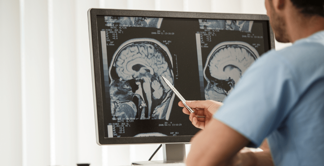 Common Symptoms and Signs of Hypoxic Brain Injury