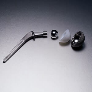 Are you a Victim of a Faulty Metal on Metal Hip Replacement?