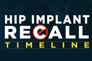 Important Timeline – Status Of Defective Hip Implant Lawsuits