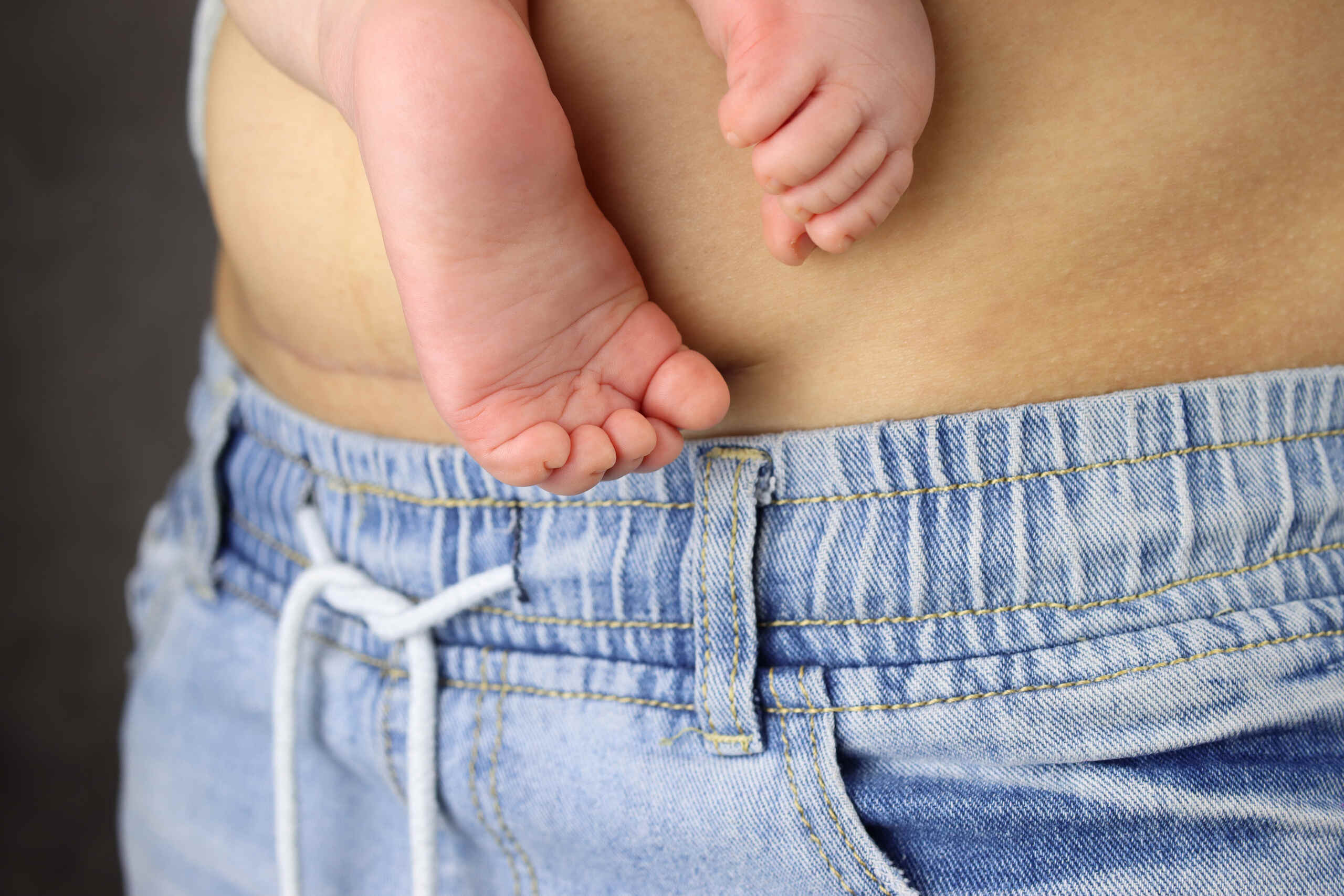 Newborn feet resting on mother's abdomen showing a C-section scar for a Tulsa birth injury attorneys page.
