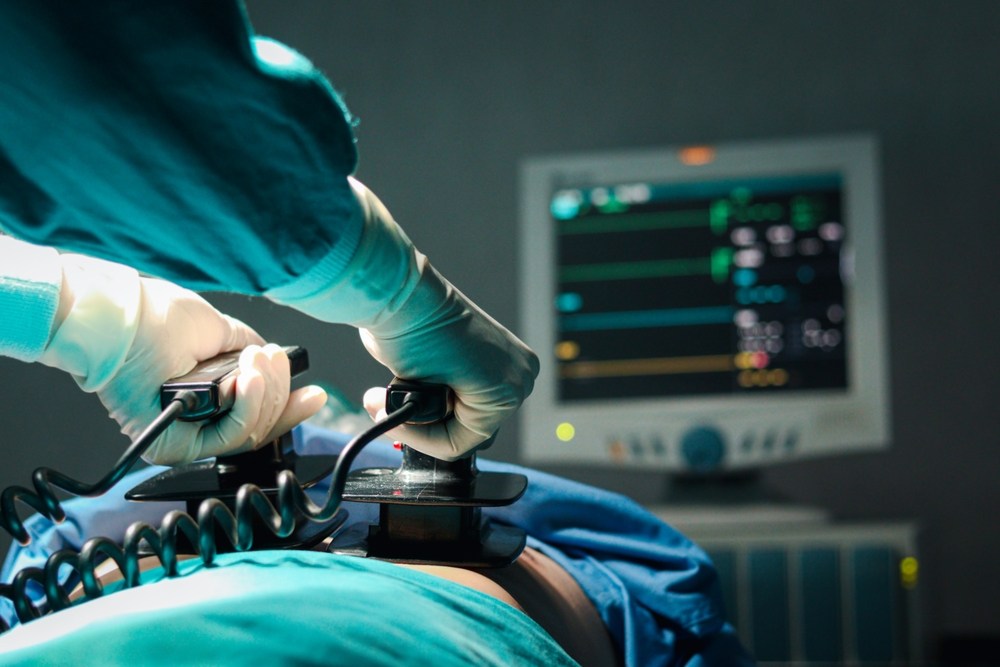 Medical team using defibrillator paddles during emergency cardiac treatment